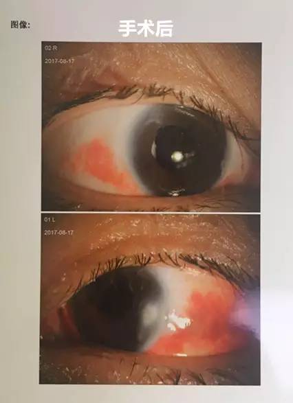 成都新利体育白内障.jpg