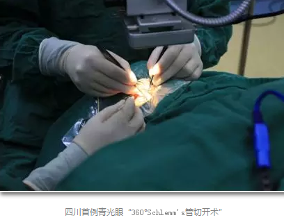 成都新利体育已经开展的青光眼手术有：引流阀 (钉)植入手术(2015年以来已200多 )，360°Schlemm's管切开术，激光CO2 辅助巩膜深层切除术，小梁切除术青(光眼)白(内障)联合手术。还有虹膜周切术、前房成形术、 虹膜复位术，睫状体冷冻术，小梁切开术和前房穿刺术等6.png