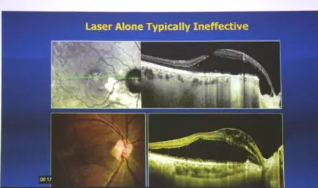 Prof. Yu-Guang He与深圳新利体育赵铁英院长一同,为患有 眼底病的患者进行了仔细的检查和病案分析,并指导医生进行诊疗,让深圳新利体育眼底病科在 眼病方面的技术水平有了进一步的提升5.png