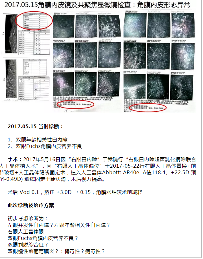 厦门眼科中心复杂性白内障手术案 研讨会持续进行7.png