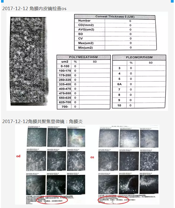 厦门眼科中心复杂性白内障手术案 研讨会持续进行8.png