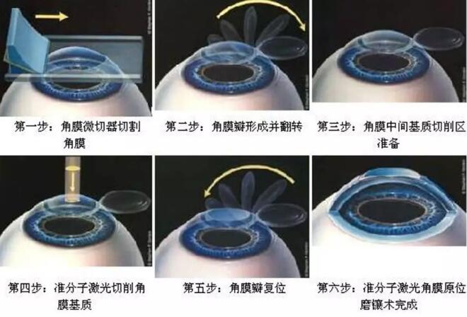 参军体检、高考志愿各 对视力要求是多少1.jpg