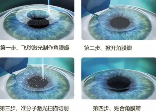 参军体检、高考志愿各 对视力要求是多少2.jpg