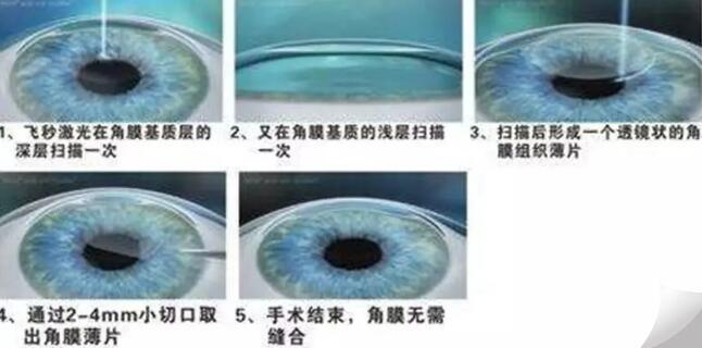 参军体检、高考志愿各 对视力要求是多少3.jpg