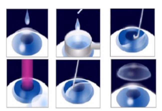 近视无法根治?但你可以这样做?新利体育“有爱就有希望”近视手术火热进行中32.png 近视无法根治?但你可以这样做?新利体育“有爱就有希望”近视手术火热进行中32.png