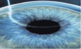 深圳新利体育近视手术直播预告丨6.24近视手术直播+福利,视界给你!!1.gif 深圳新利体育近视手术直播预告丨6.24近视手术直播+福利,视界给你!!1.gif