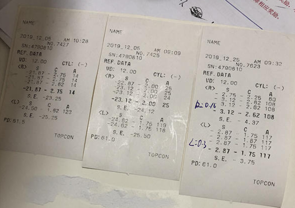 在杭州新利体育高度近视手术后，近视2550度配不到眼镜的四川大哥，看清了！2.png
