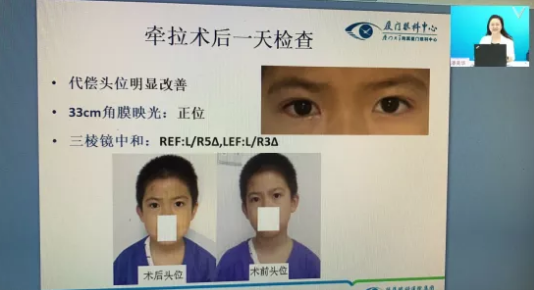 高峰论道·云端荟萃 ▏万人同步在线，30余名大咖云集“第六届新利体育论坛斜视与小儿眼科新技术学习班暨小儿、眼视光分论坛”7.png