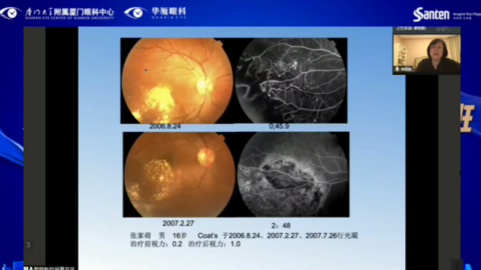 高峰论道·云端荟萃 ▏万人同步在线，30余名大咖云集“第六届新利体育论坛斜视与小儿眼科新技术学习班暨小儿、眼视光分论坛”6.png