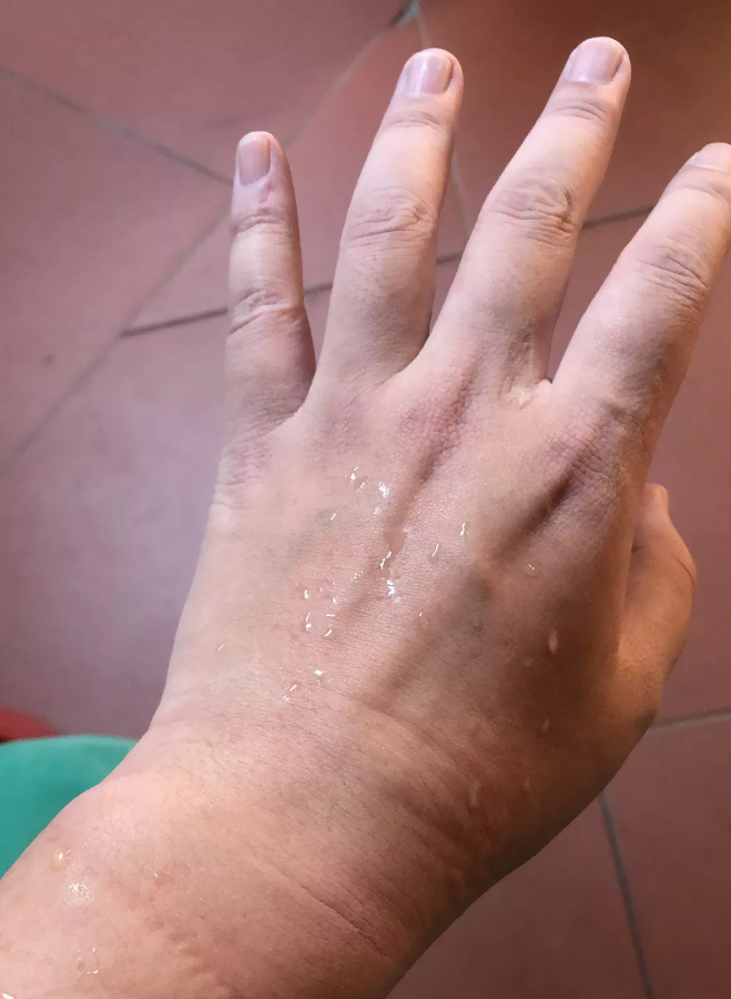 为家乡献力,为平安出征,记莆田眼科医院医护人员抗“疫”故事5.png 为家乡献力,为平安出征,记莆田眼科医院医护人员抗“疫”故事5.png