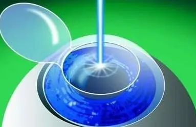 半飞秒 (2).png 半飞秒 (2).png